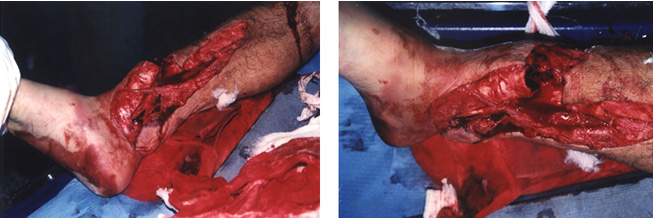 NG电子游戏·(中国区)官方网站