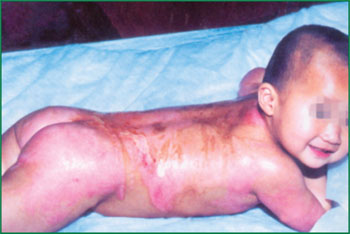 NG电子游戏·(中国区)官方网站