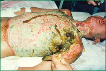 NG电子游戏·(中国区)官方网站