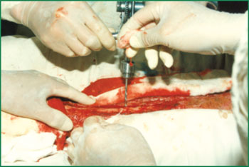 NG电子游戏·(中国区)官方网站