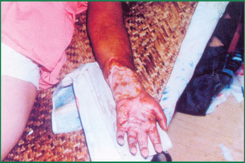 NG电子游戏·(中国区)官方网站