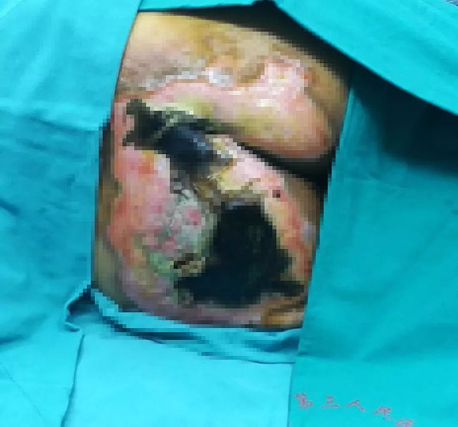 NG电子游戏·(中国区)官方网站