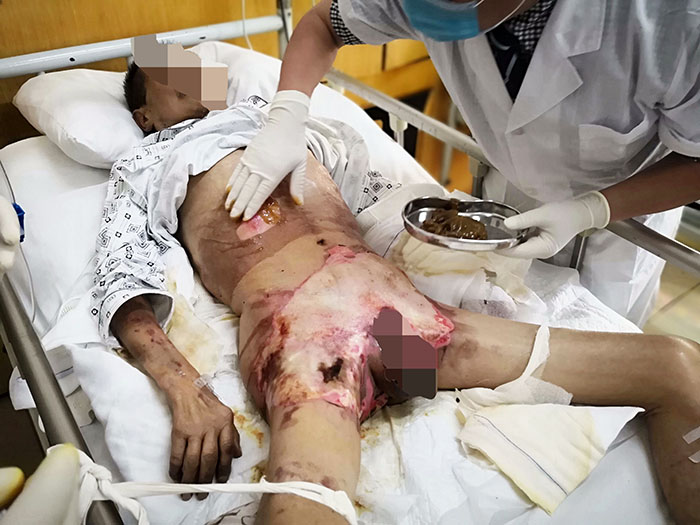 NG电子游戏·(中国区)官方网站