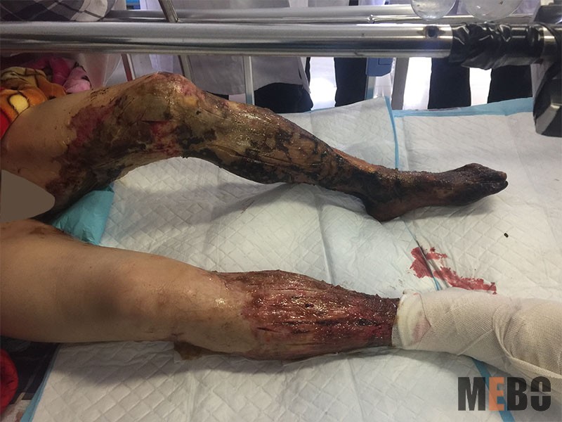 NG电子游戏·(中国区)官方网站