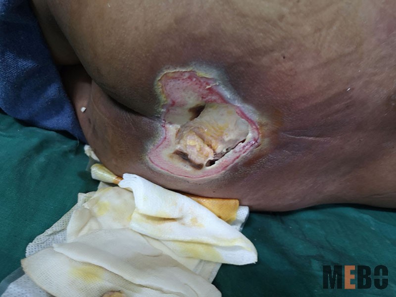 NG电子游戏·(中国区)官方网站