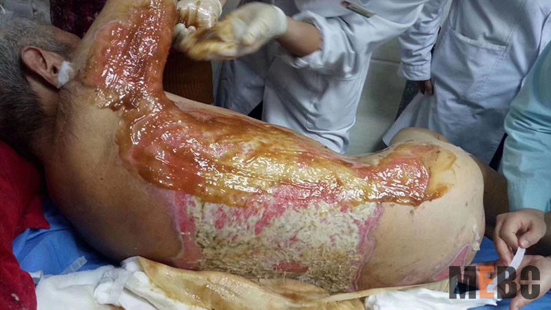 NG电子游戏·(中国区)官方网站