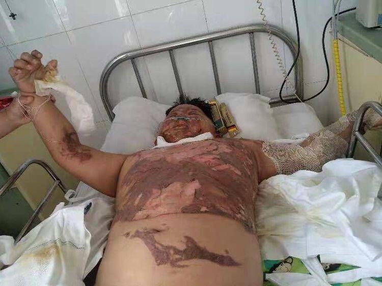 NG电子游戏·(中国区)官方网站