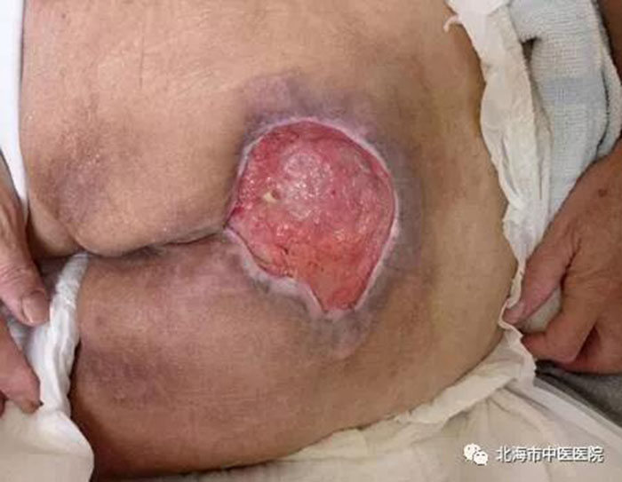 NG电子游戏·(中国区)官方网站