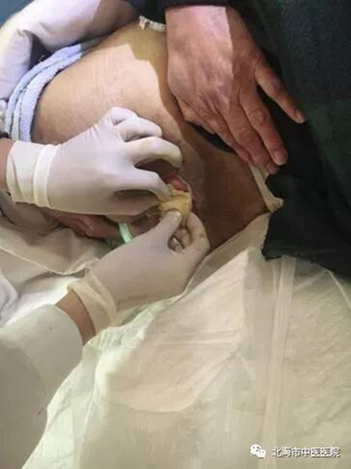 NG电子游戏·(中国区)官方网站