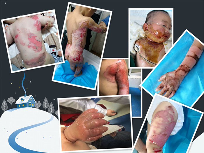 NG电子游戏·(中国区)官方网站