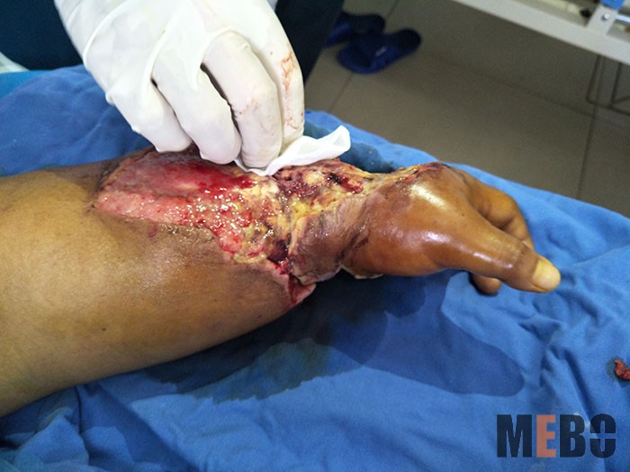 NG电子游戏·(中国区)官方网站