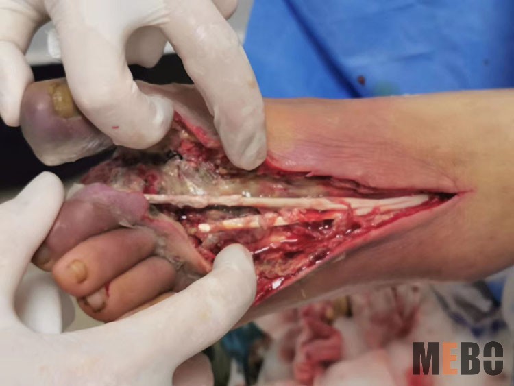 NG电子游戏·(中国区)官方网站