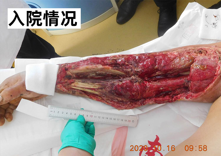 NG电子游戏·(中国区)官方网站