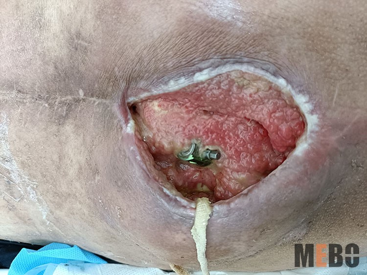 NG电子游戏·(中国区)官方网站