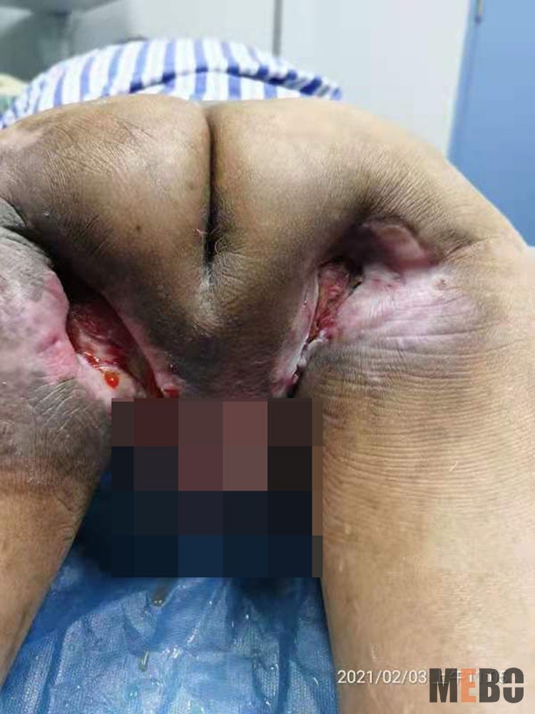 NG电子游戏·(中国区)官方网站