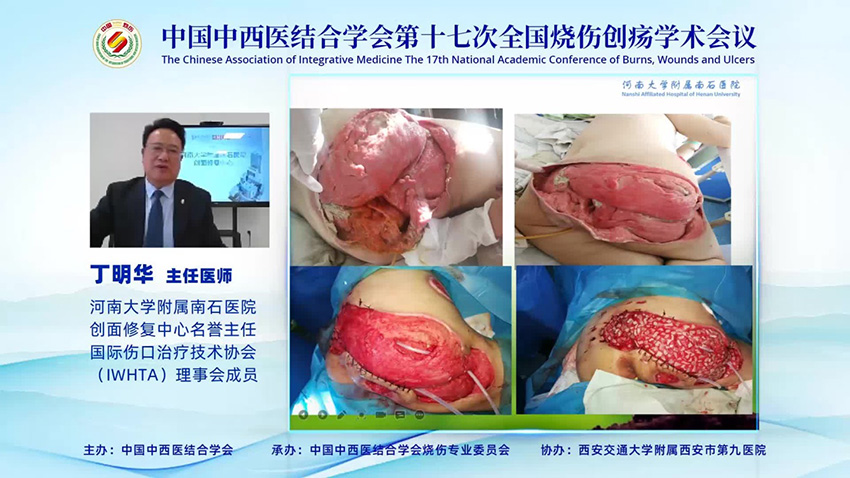NG电子游戏·(中国区)官方网站