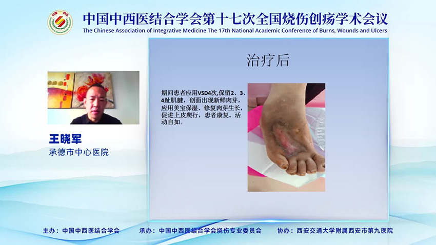 NG电子游戏·(中国区)官方网站