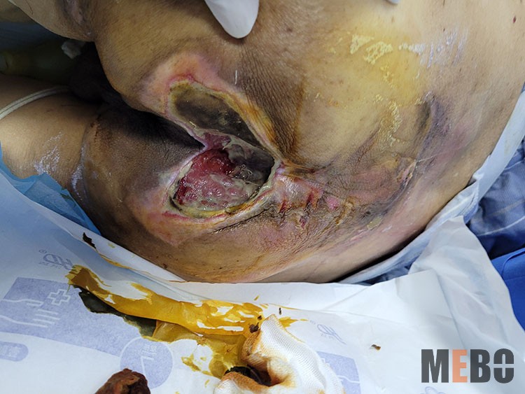 NG电子游戏·(中国区)官方网站