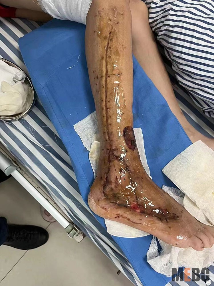 NG电子游戏·(中国区)官方网站