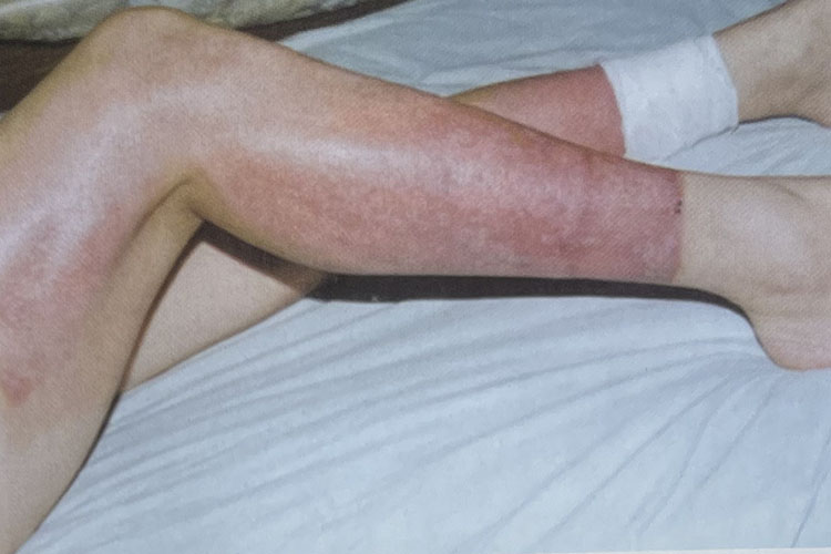 NG电子游戏·(中国区)官方网站