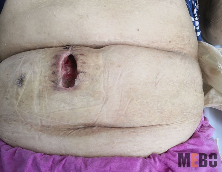 NG电子游戏·(中国区)官方网站