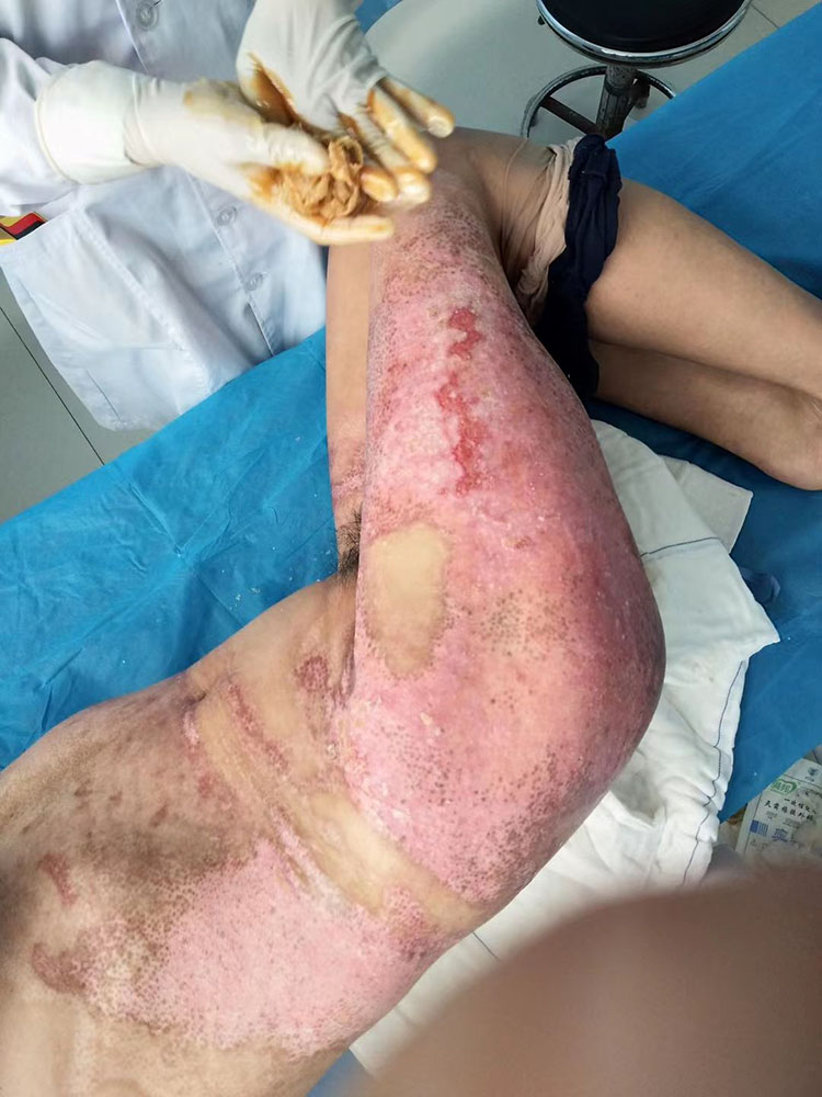 NG电子游戏·(中国区)官方网站