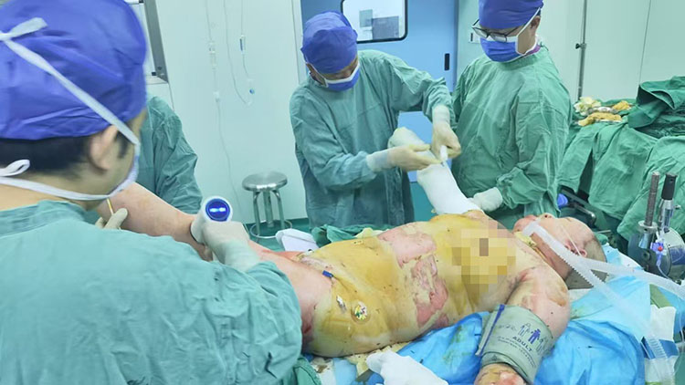 NG电子游戏·(中国区)官方网站