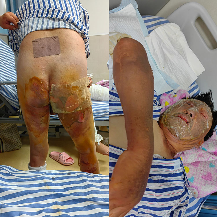 NG电子游戏·(中国区)官方网站