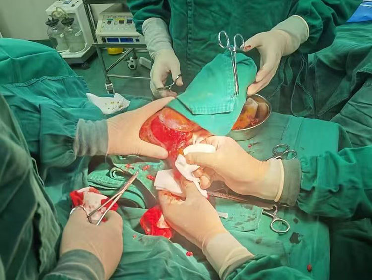 NG电子游戏·(中国区)官方网站