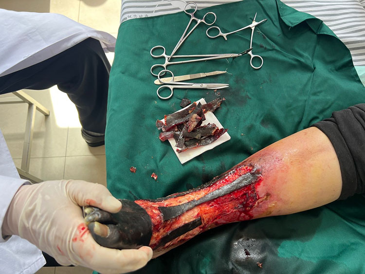 NG电子游戏·(中国区)官方网站