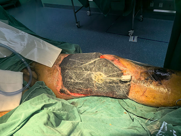 NG电子游戏·(中国区)官方网站