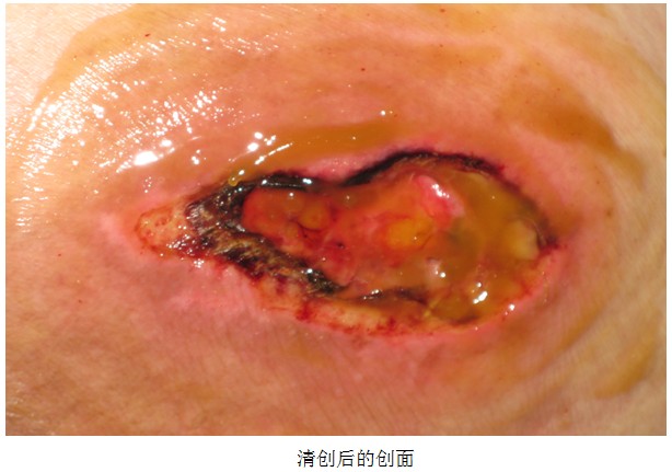 NG电子游戏·(中国区)官方网站