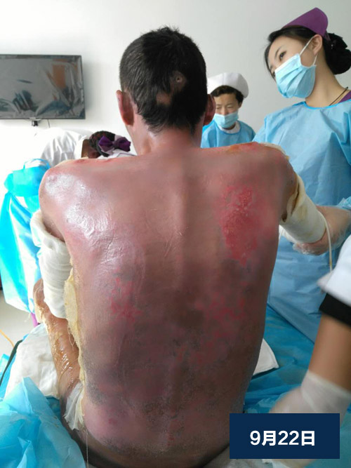 NG电子游戏·(中国区)官方网站