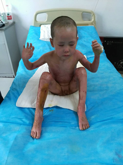 NG电子游戏·(中国区)官方网站